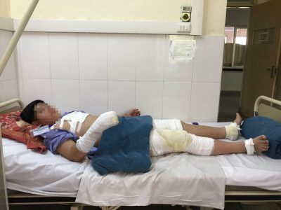 Ảnh hưởng tới sức khỏe con người.